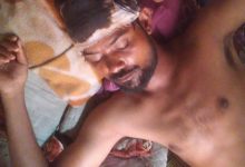 युवक के सिर में आई चोट; पुलिस ने दर्ज किया मुकदमा