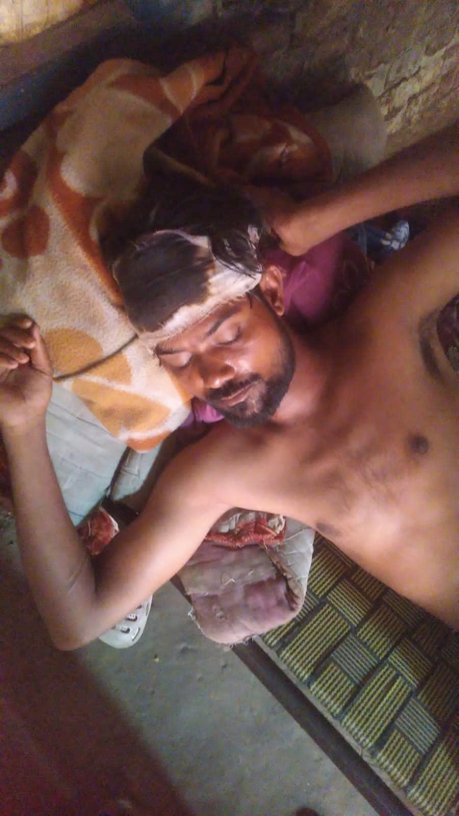 युवक के सिर में आई चोट; पुलिस ने दर्ज किया मुकदमा